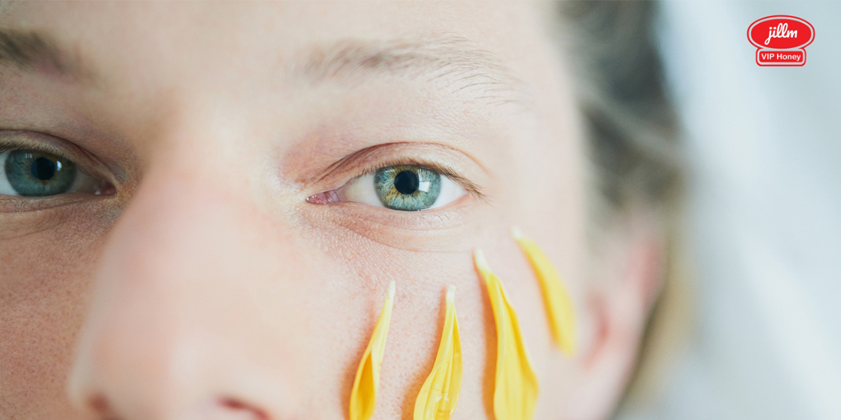 Honey for sunburn face relief