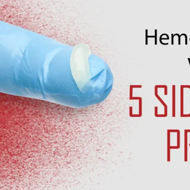How To Prevent Hemorrhoid In Late Pregnancy: 7 Causes [Must Know]
