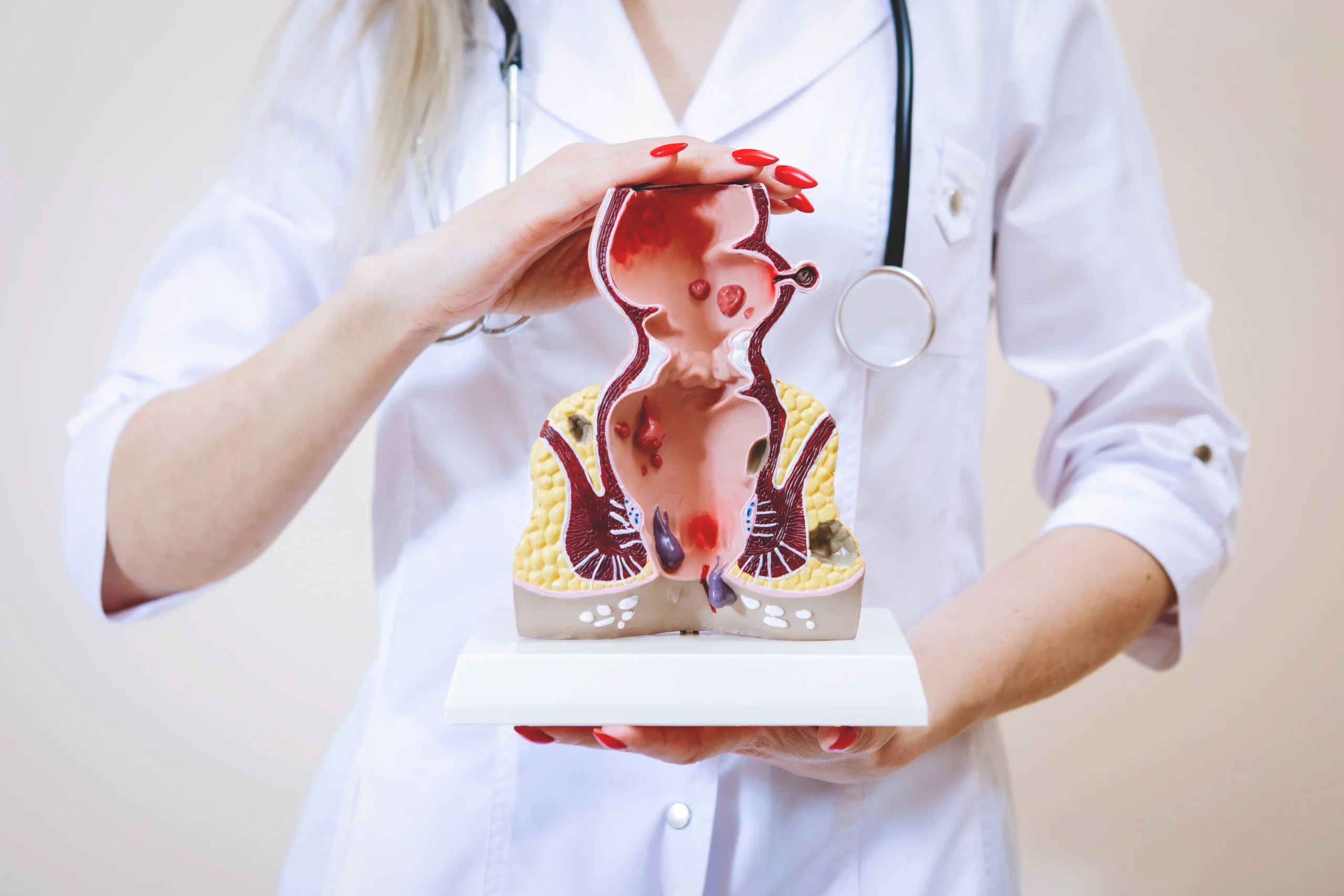 Hemorrhoid in the internal organs is one of the most common medical conditions