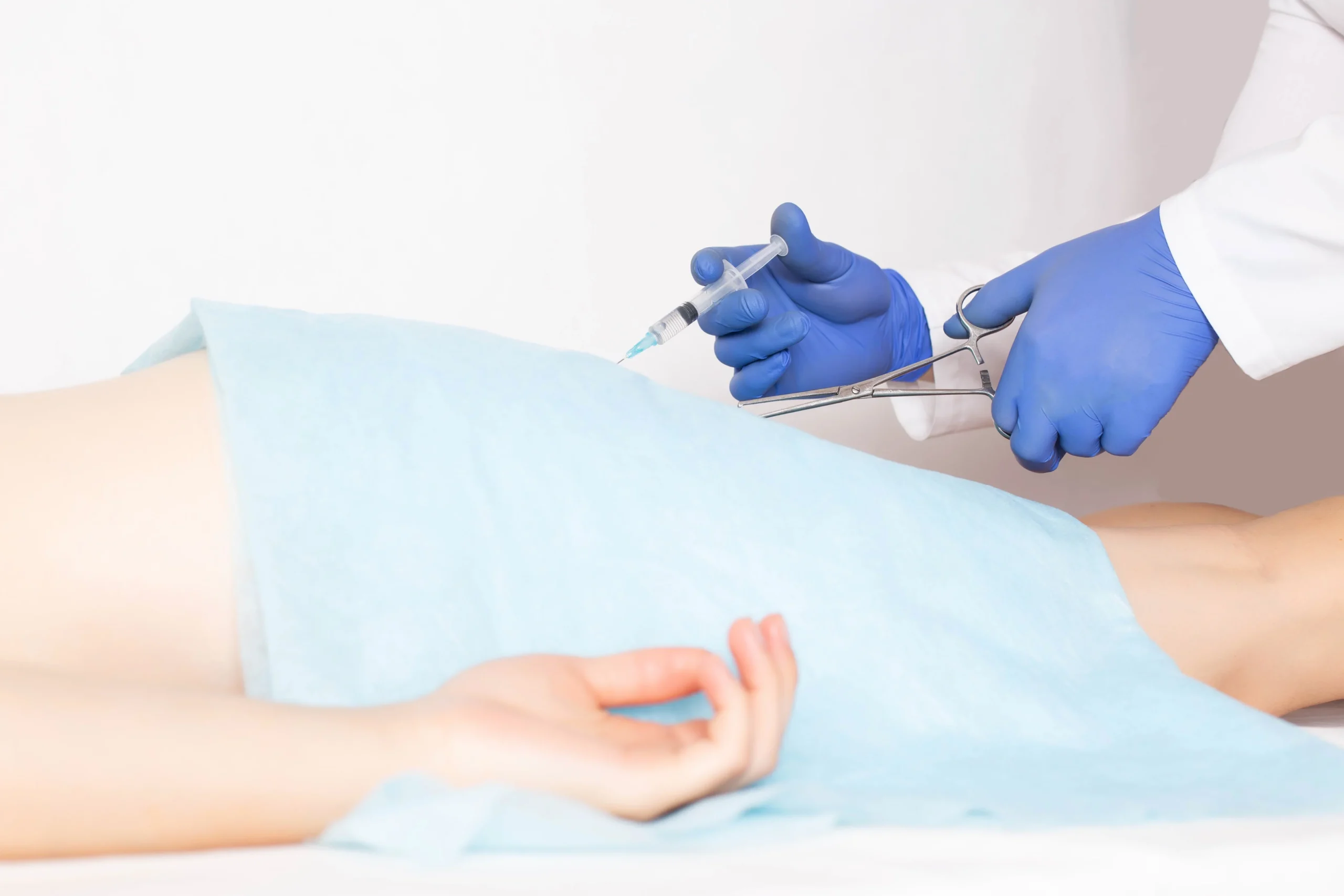 Surgical procedures used for the treatment of hemorrhoids