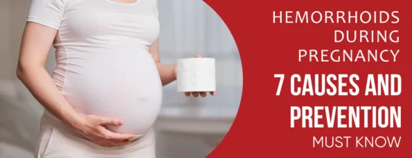 Must-Know Guide to Hemorrhoids During Pregnancy