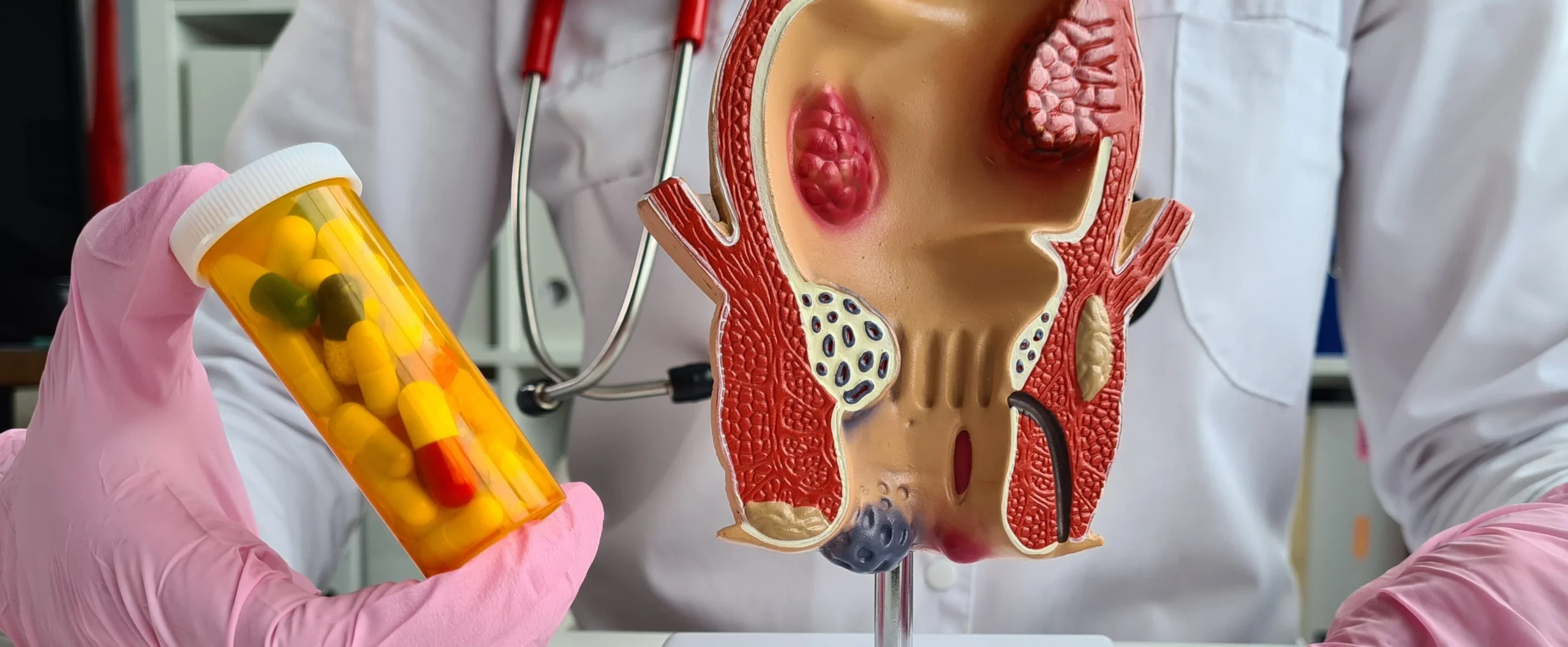 2 situations when hemorrhoids are painful