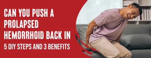 5 Steps to Push back a Prolapsed Hemorrhoid