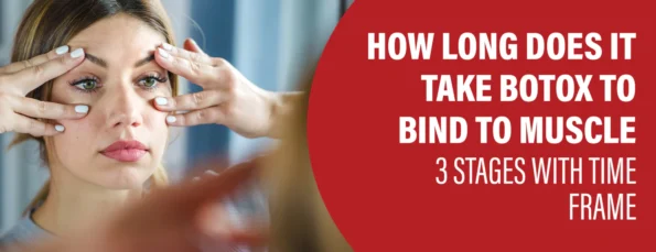 Botox takes a long time to bind to the muscle when it is injected