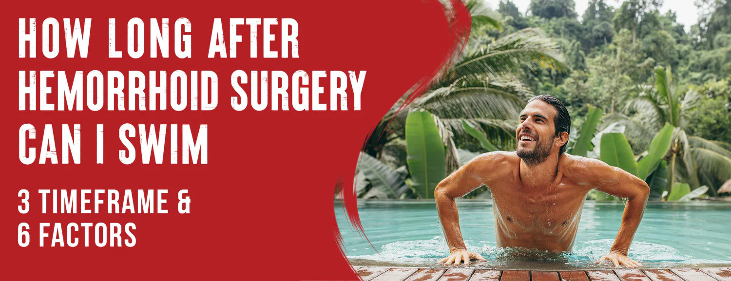 Considering 6 Factors When Swimming After Hemorrhoid Surgery
