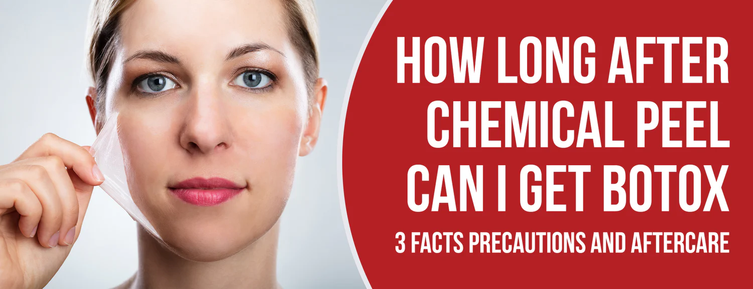 Facts and benefits of Botox treatment about chemical peels