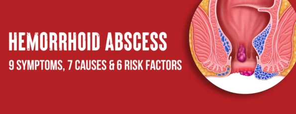 An abscess due to hemorrhoids