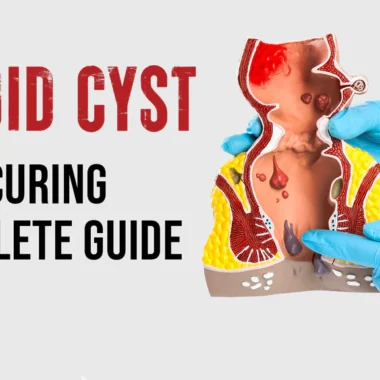 Can Hemorrhoid Cream Cause Yeast Infection: 4 Reasons