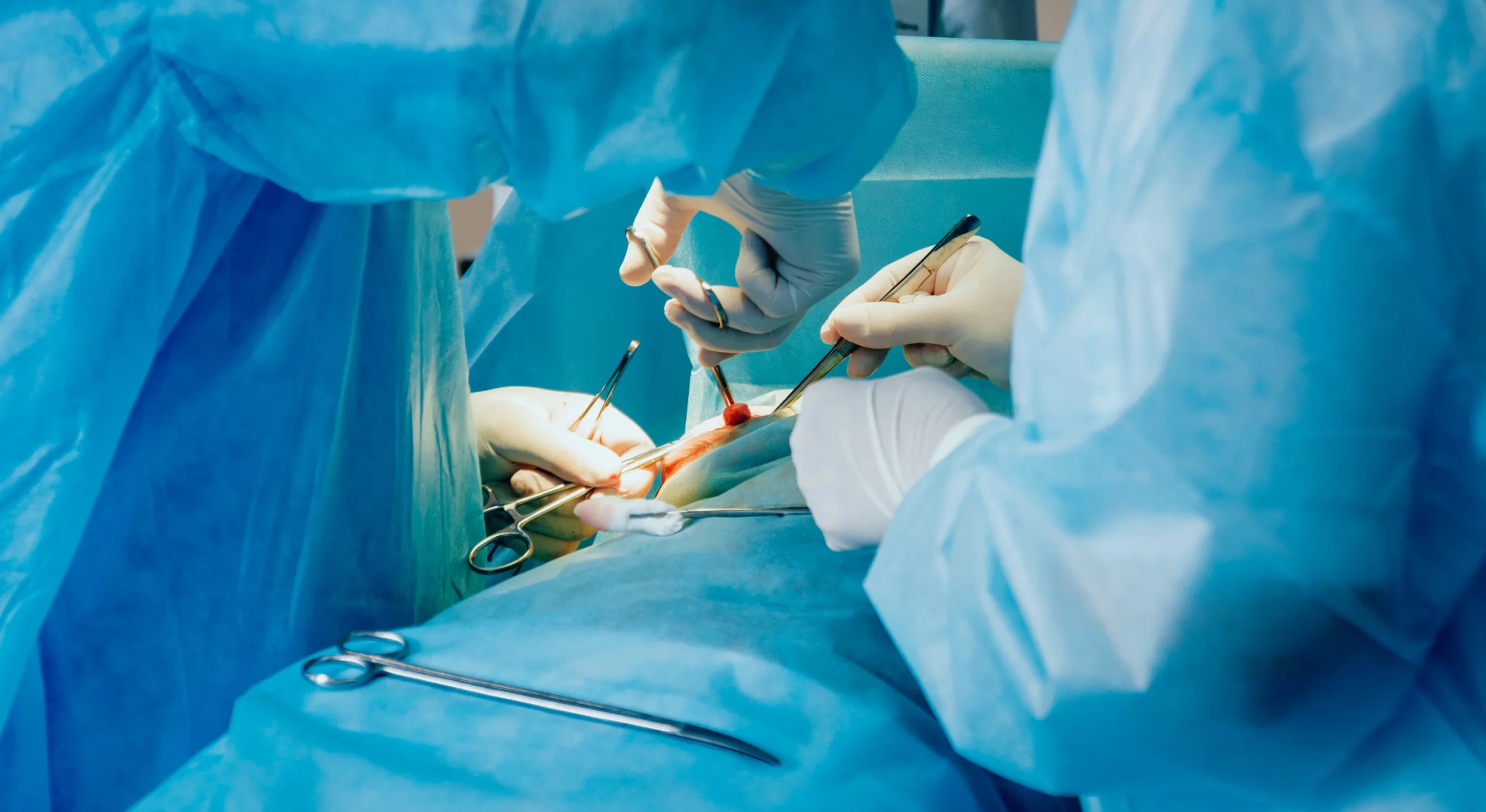 Hemorrhoid Surgery Timeframe & Factors Affecting It