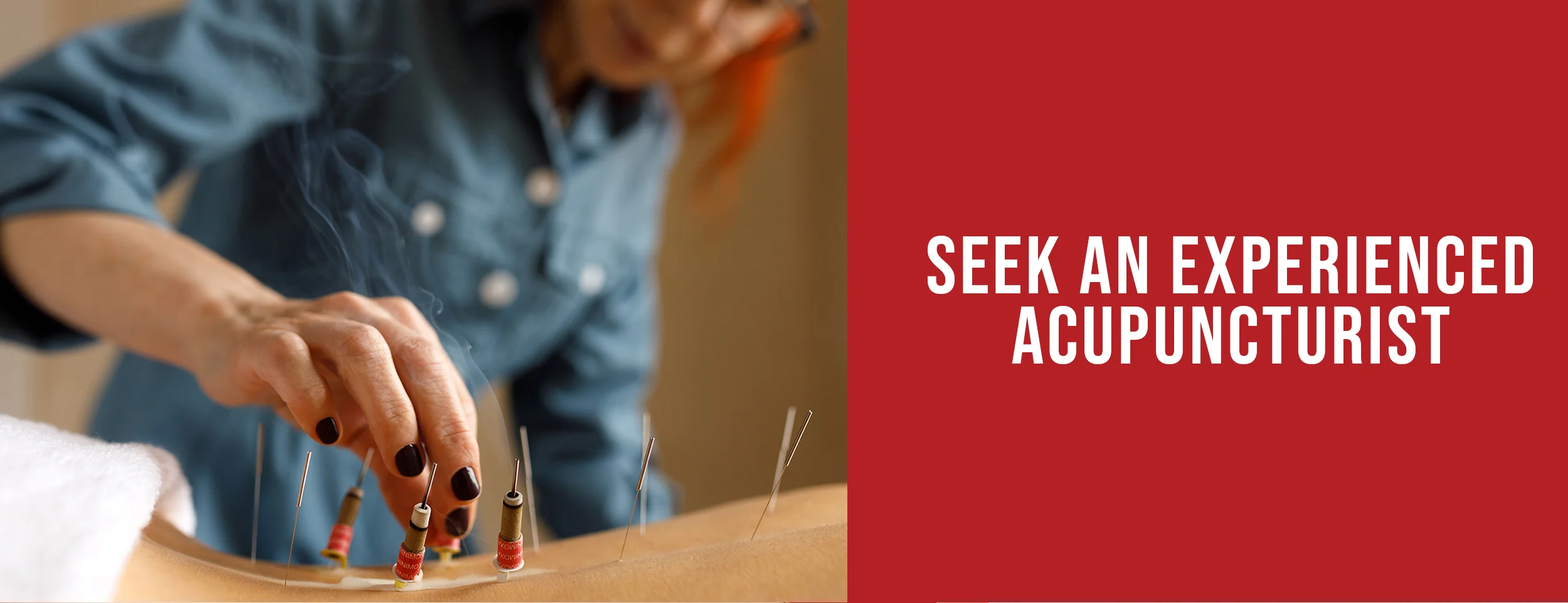 Make An Appointment With An Experienced Acupuncturist