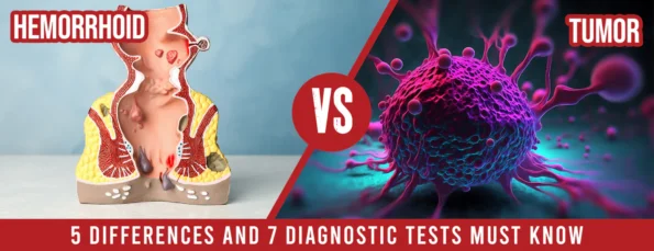 The Difference Between a Hemorrhoid and a Tumor