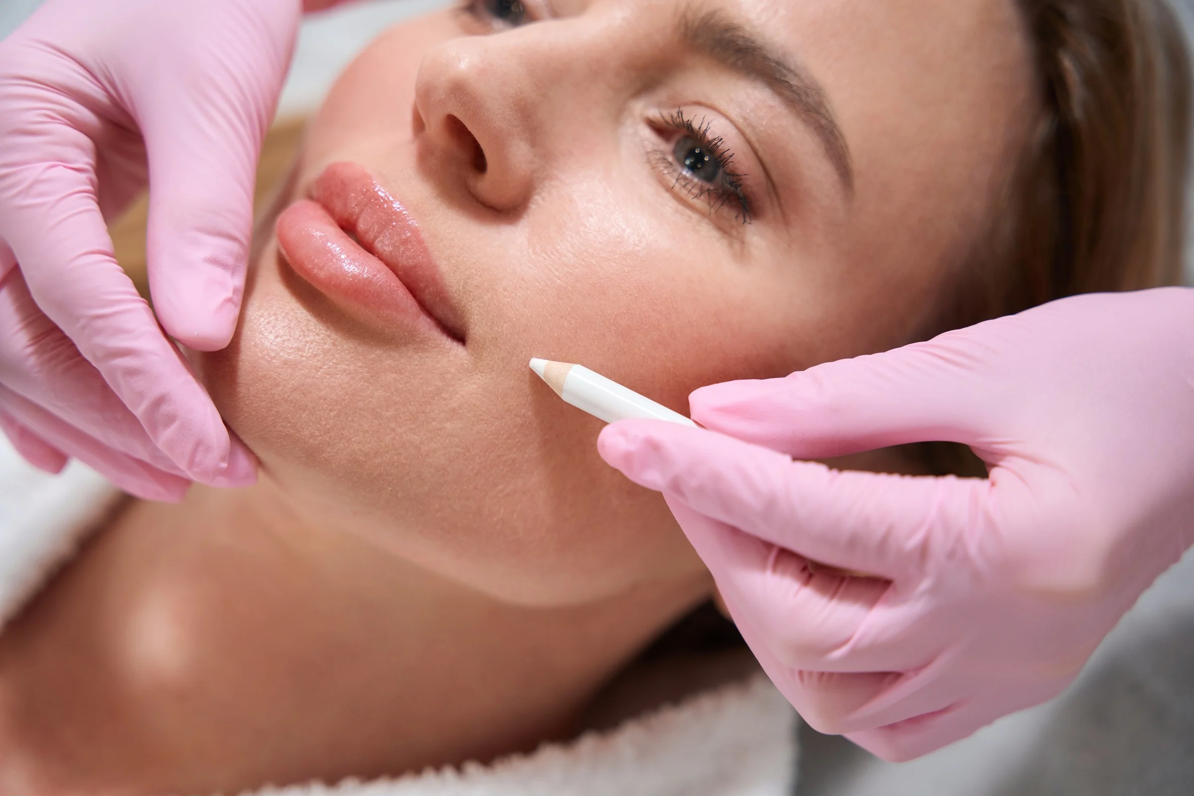 The Longevity of Botox In Lips