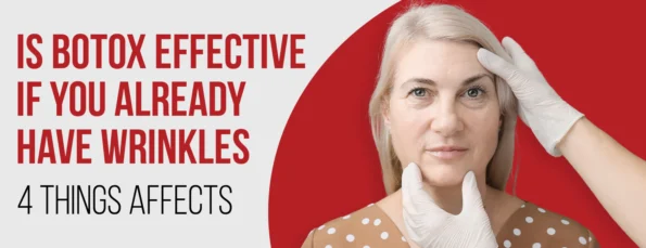The effects of already having wrinkles on Botox efficacy and treatment