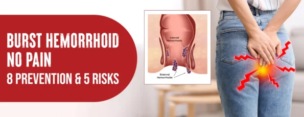 There are 5 causes and 4 symptoms of a burst hemorrhoid without pain 4 ways to prevent it