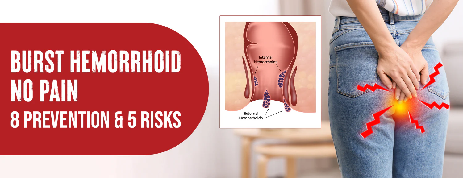 There are 5 causes and 4 symptoms of a burst hemorrhoid without pain 4 ways to prevent it