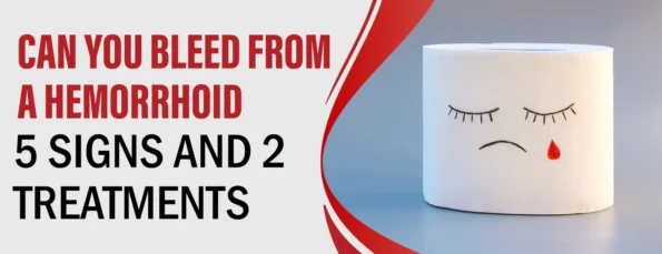 A hemorrhoid is a bleeding that occurs within the body