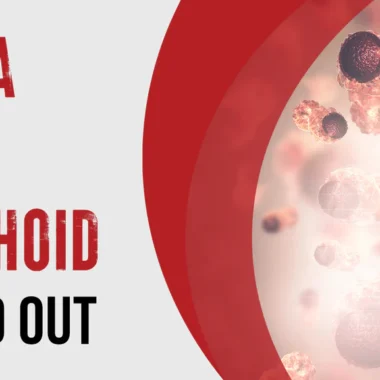 Can Hemorrhoid Cream Cause Yeast Infection: 4 Reasons