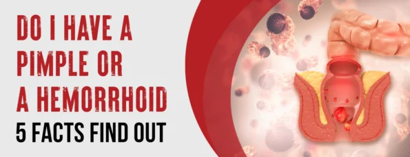 Here are 5 facts you need to know about pimples and hemorrhoids
