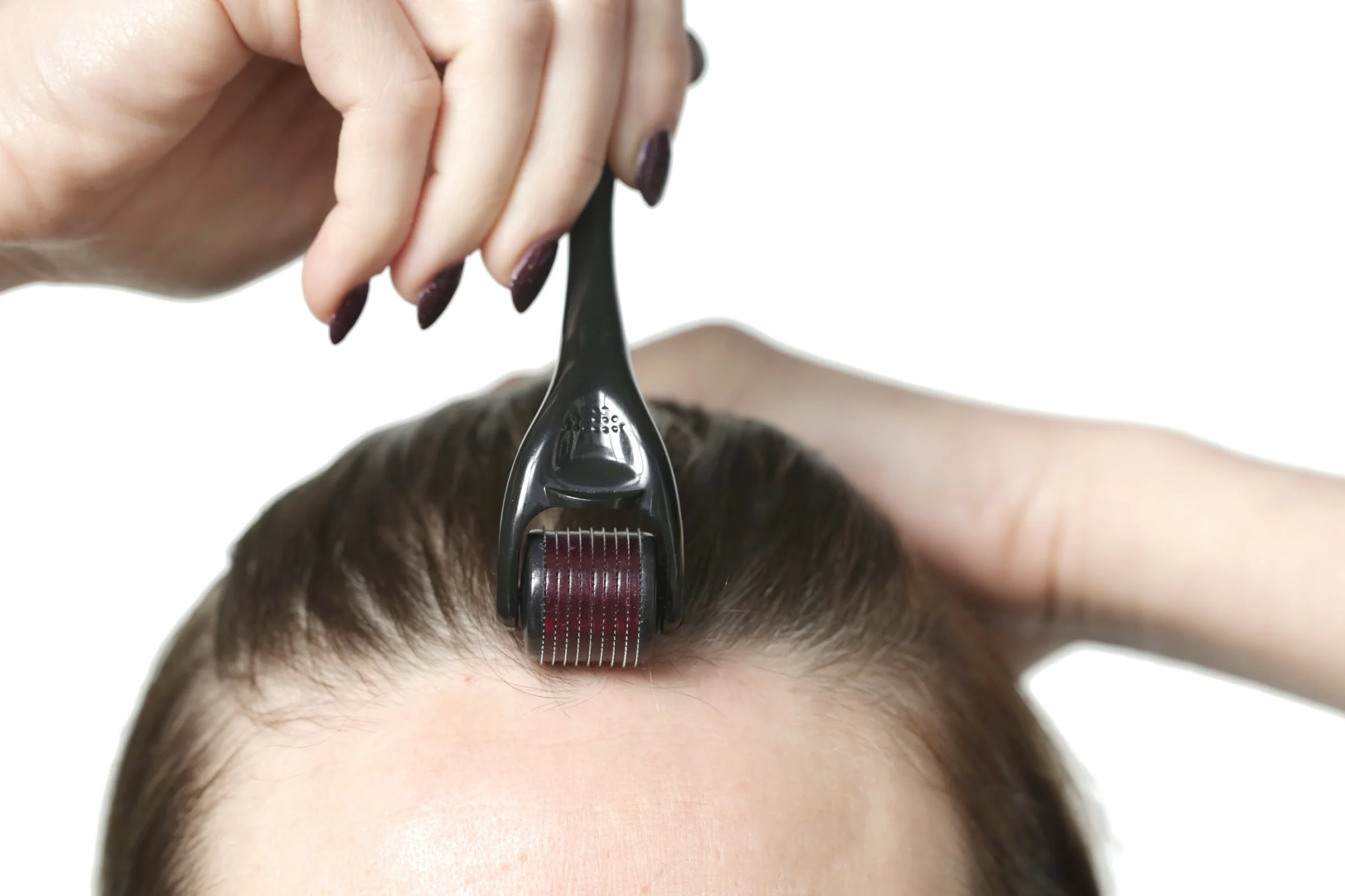3 Benefits of Using a Derma Roller for Hair Growth