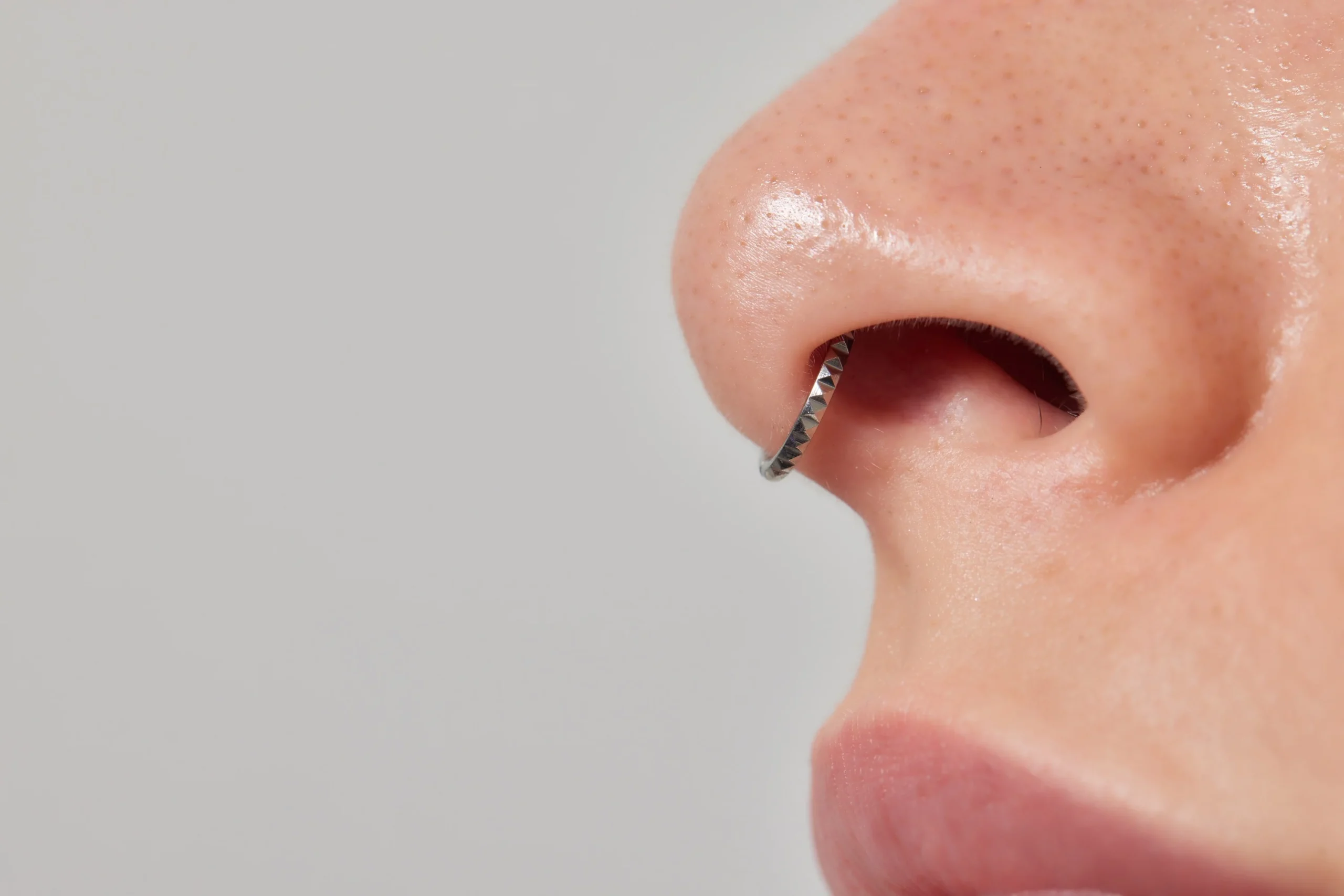 4 Causes of a Nose Piercing Bump
