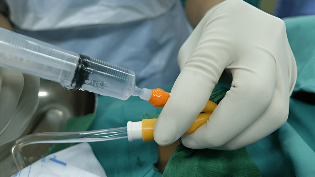 Hemorrhoids Treatment for Hard to Pee