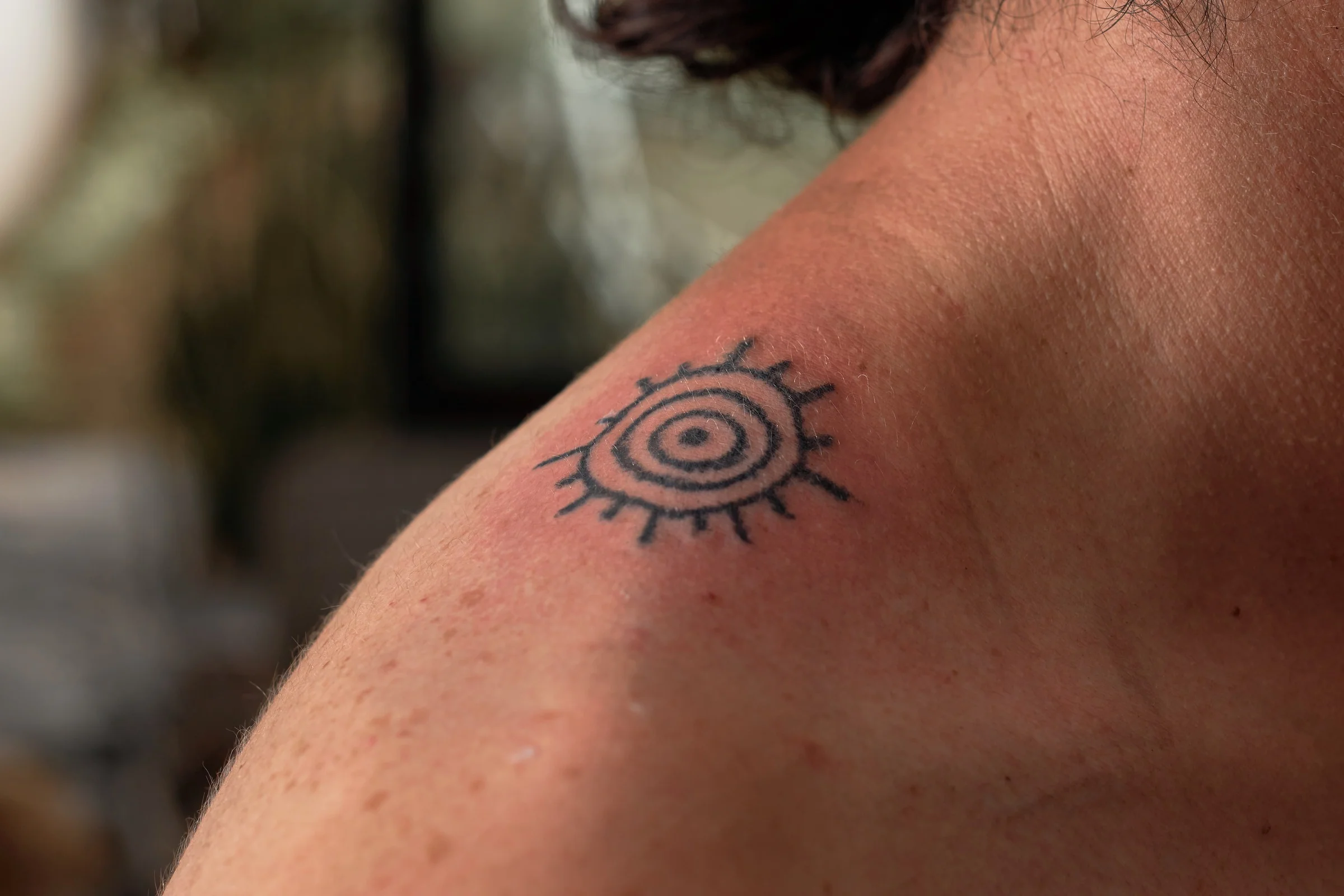 Irritated skin risks and side effects of DIY home tattoo removal