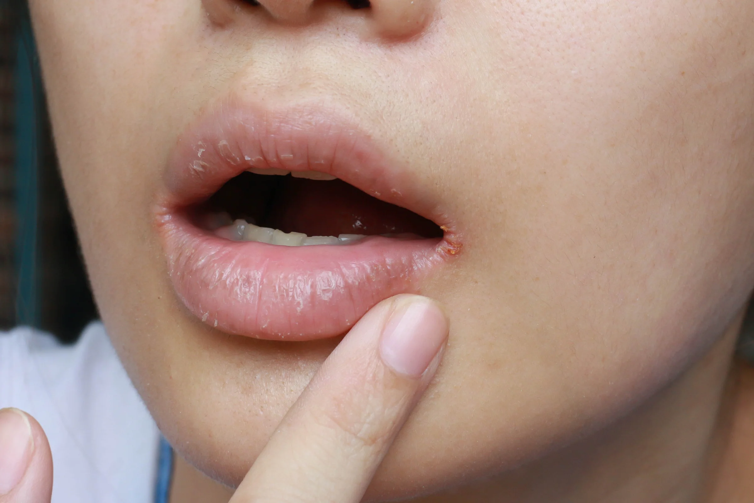 Lip blush tattoo risks and mistakes