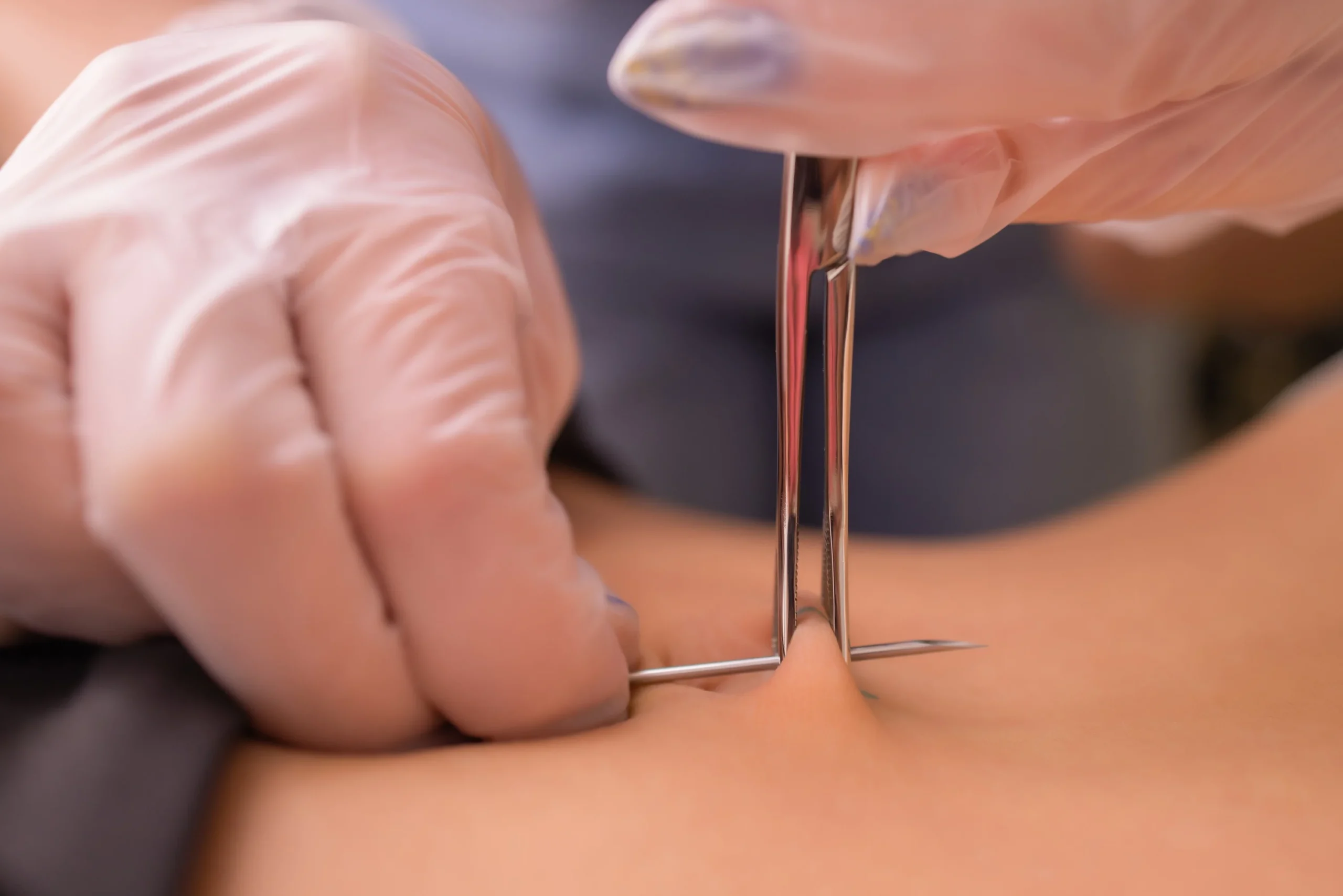 Structural factors can affect piercing pain, like skin and tissue thickness