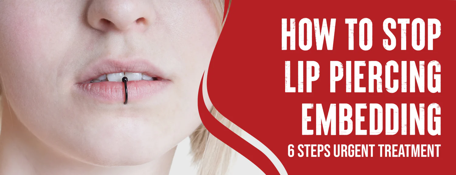 The Immediate Steps & Preventive Measures to Stop Lip Piercing Embedding