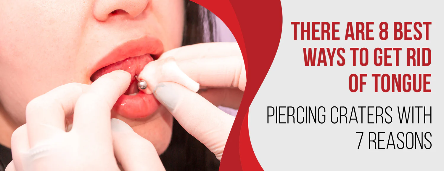 There are 8 best ways to get rid of tongue piercing craters with 7 reasons