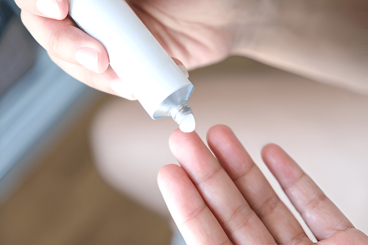 Treatment of Prolapsed Hemorrhoids
