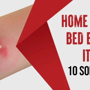 Most Painful Insect Bites: 10 Types [How to Avoid Them]