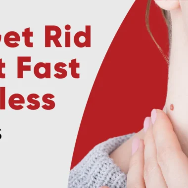 Home Remedies for Treating Pruritus Ani: 9 Tips