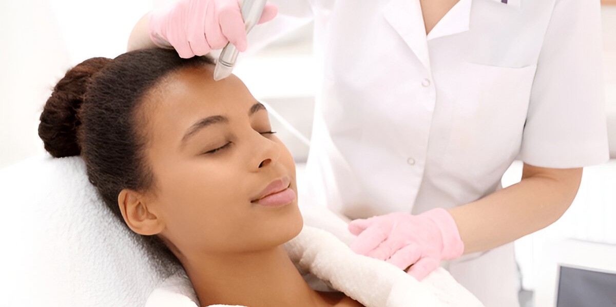 14 benefits of microneedling for the face Must Learn