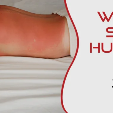 Can You Shave With A Sunburn: 8 Impact & 9 Factors Consider