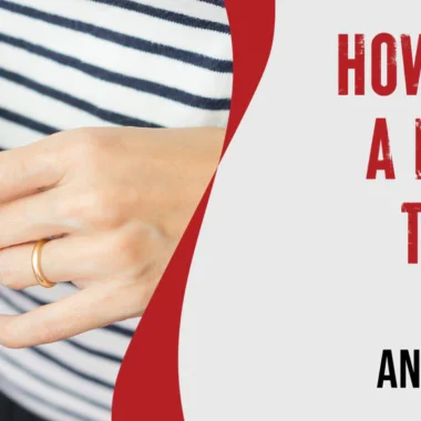 What To Do For Welding Burns on Skin | 8 Precautions