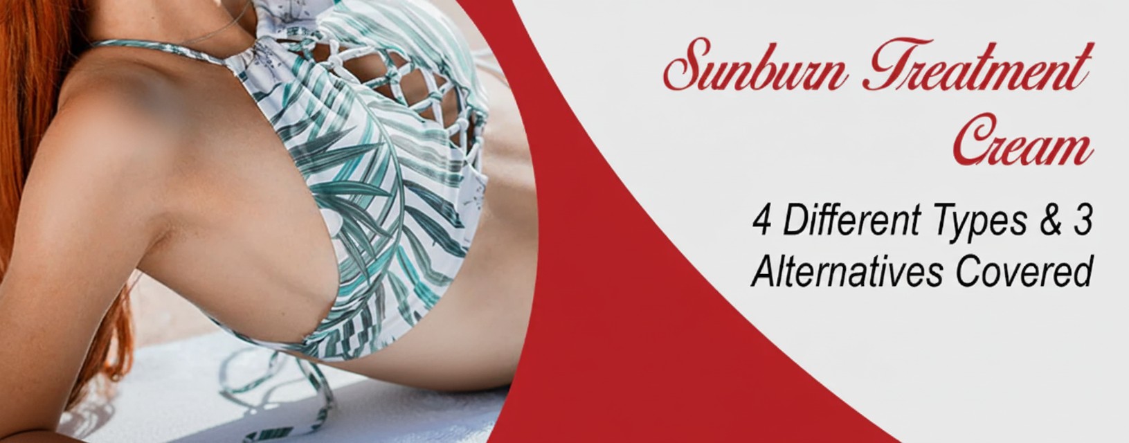 4 Different Sunburn Treatment Creams & 3 Alternatives