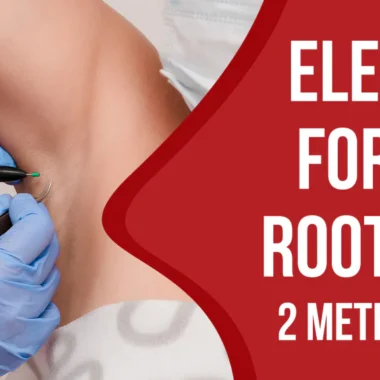 Electrolysis is Hair and Root Removal | 2 Methods With Steps