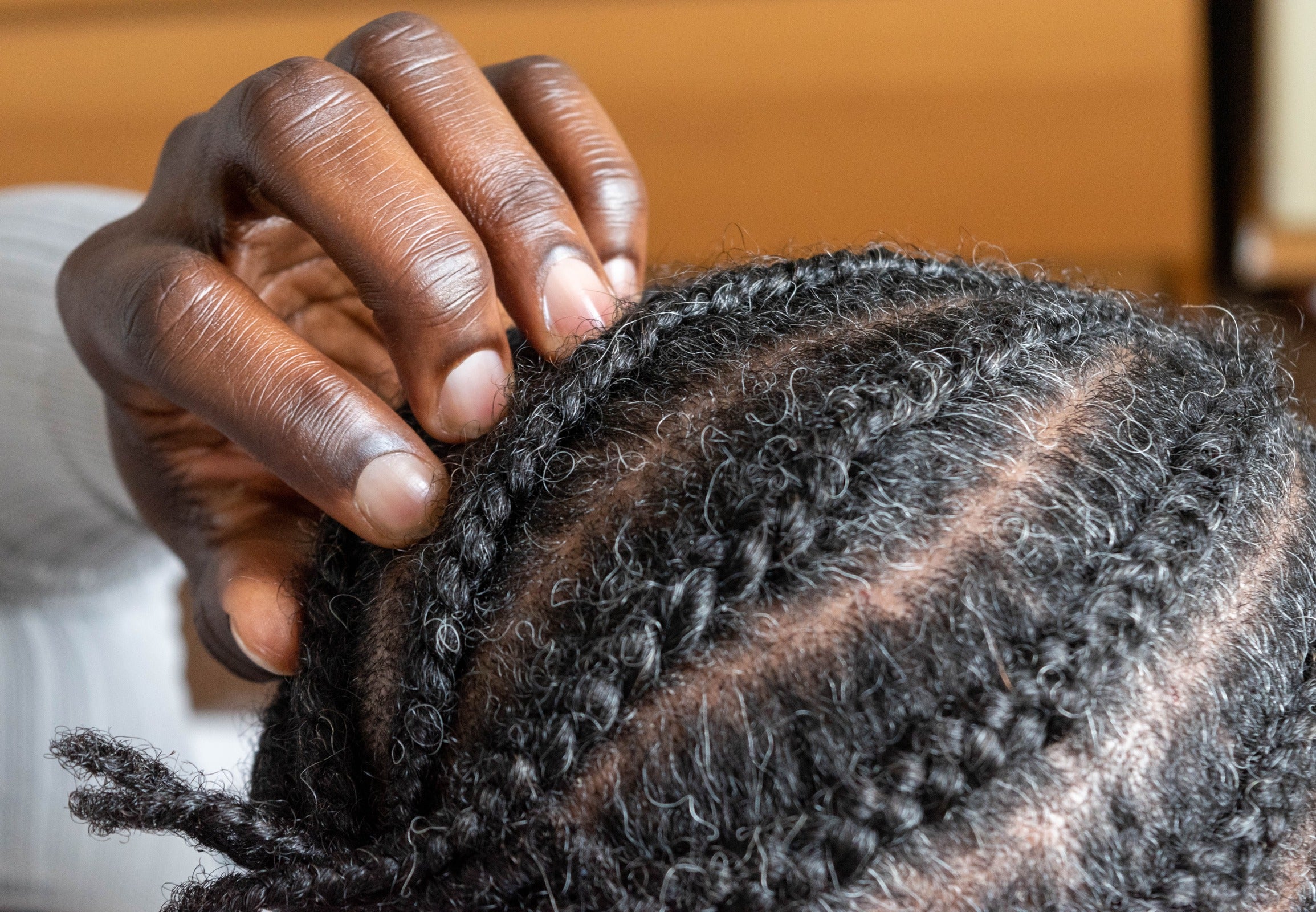 5 Best Tips and 3 Precautions for Removing Dandruff From Braids