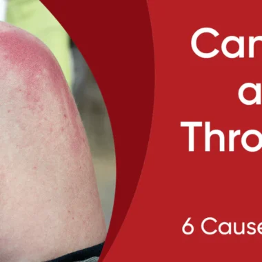 Can You Shave With A Sunburn: 8 Impact & 9 Factors Consider