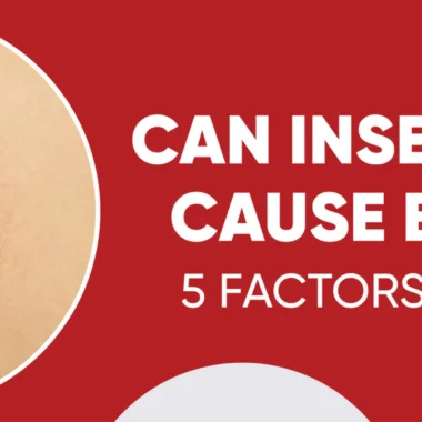 Most Painful Insect Bites: 10 Types [How to Avoid Them]