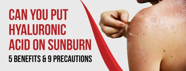 8 Benefits & 9 Precautions of Hyaluronic Acid for Sunburn