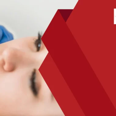 Electrolysis Blonde Facial Hair: 3 Factors [Permanent]