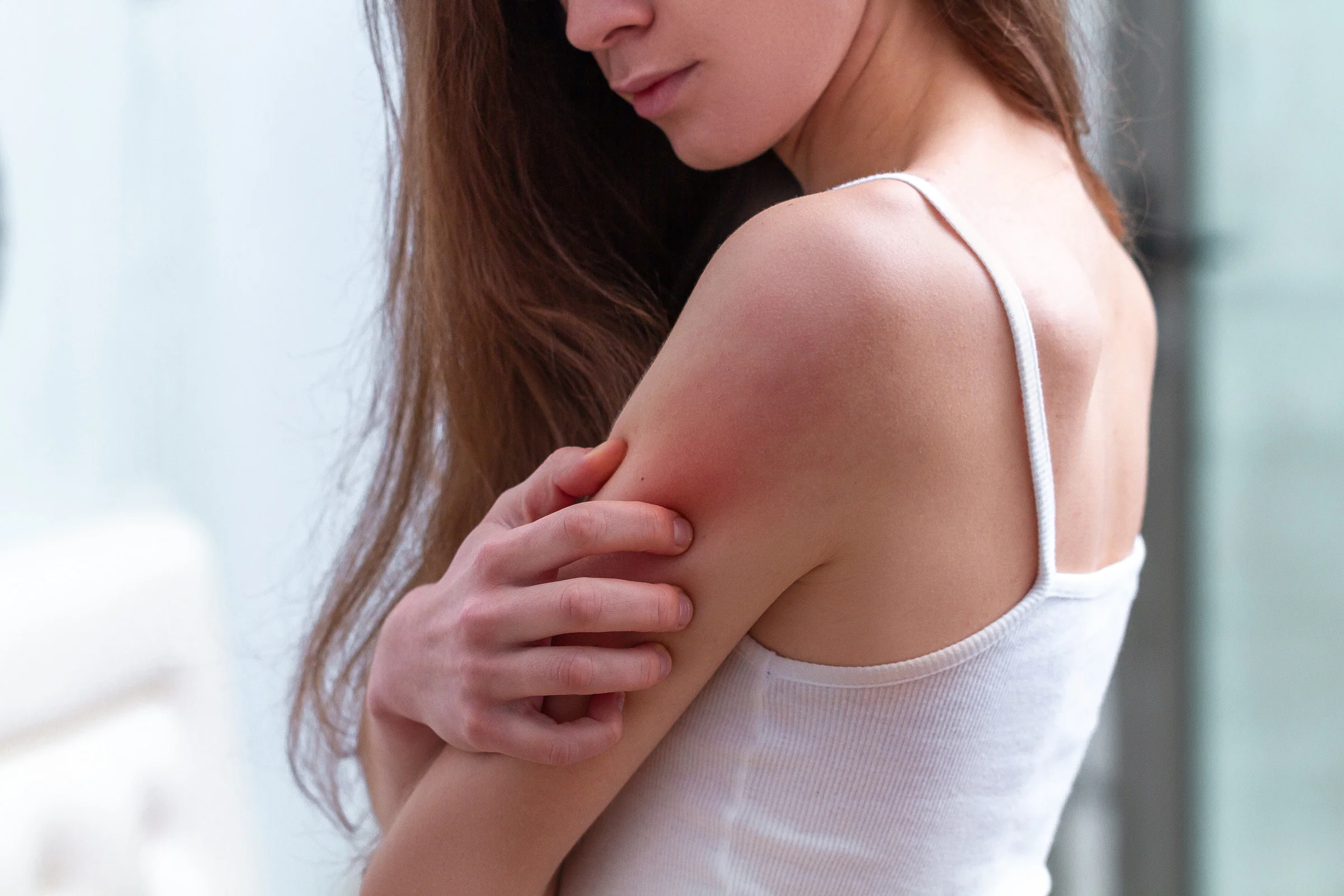 Body Wash Allergic Reaction Symptoms