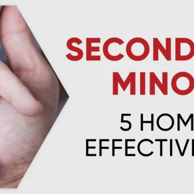 What To Do For Welding Burns on Skin | 8 Precautions