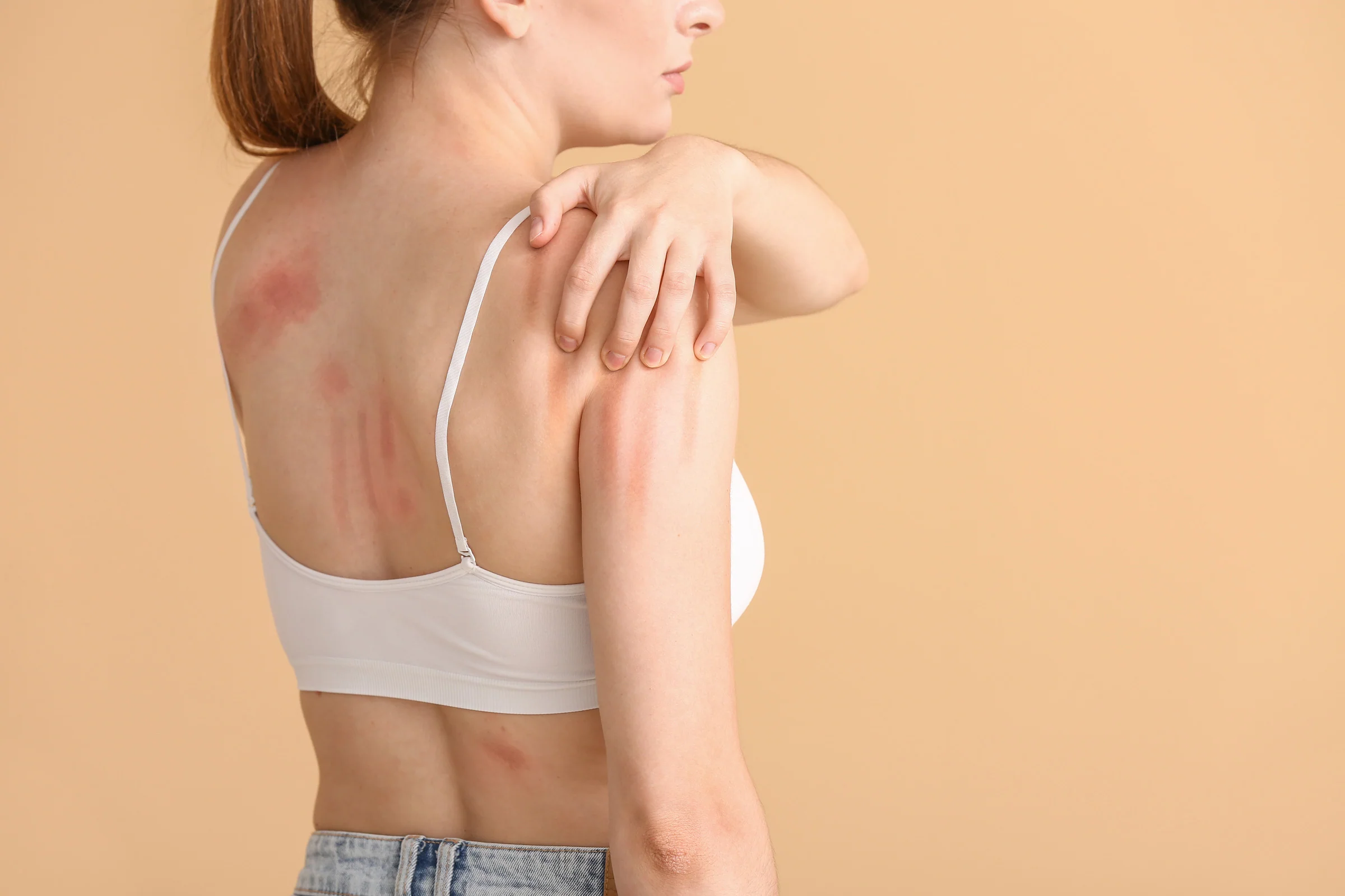 Can Baking Soda Cause Skin Irritation 7 Real Reasons