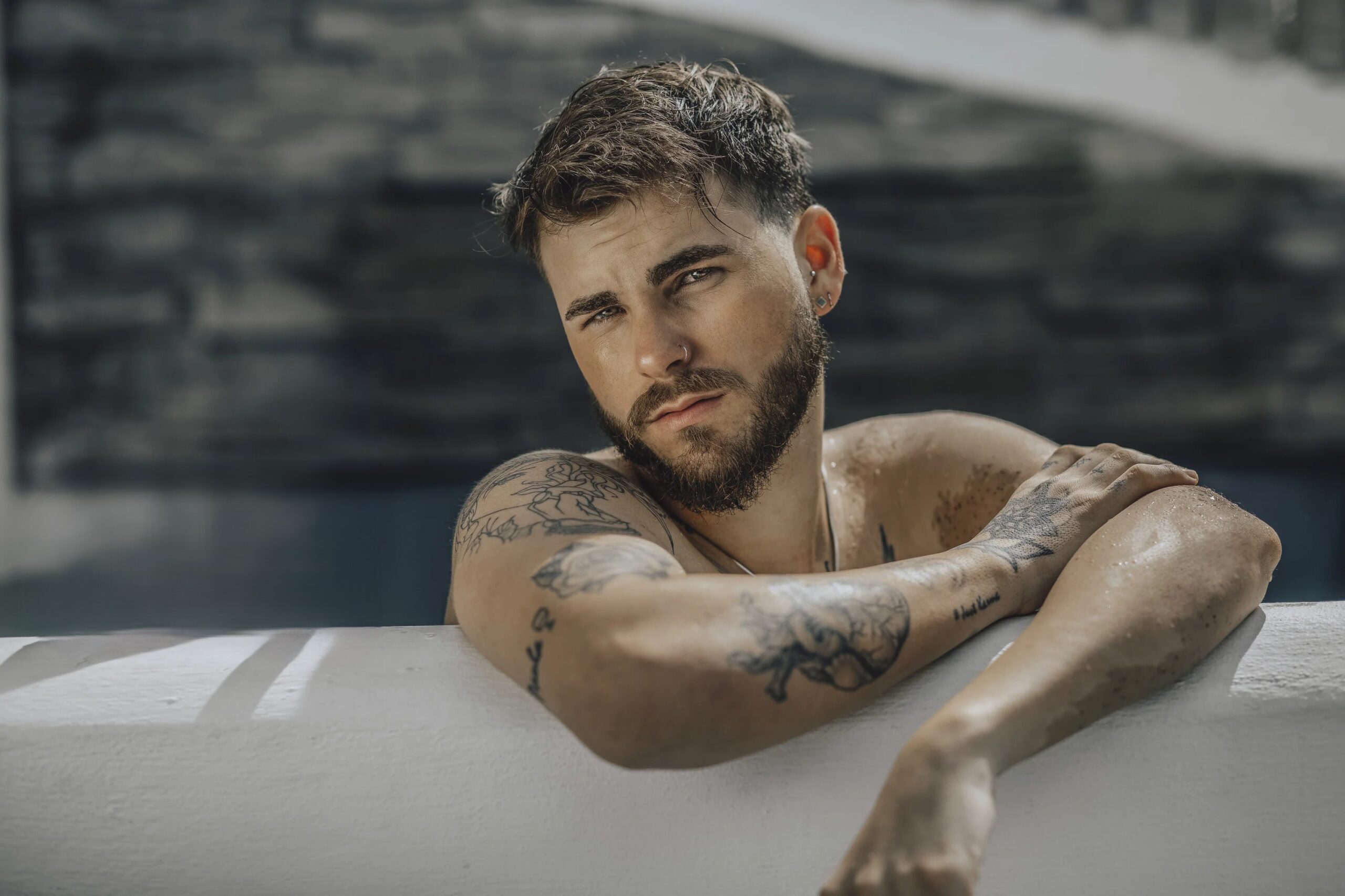 Choosing the Right Sunburn Treatment Cream