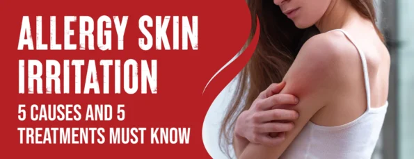 Common Causes & Treatments for Allergy Skin Irritation
