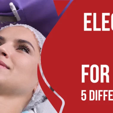 Electrolysis or Laser for Facial Hair: 5 Factors [Essential]