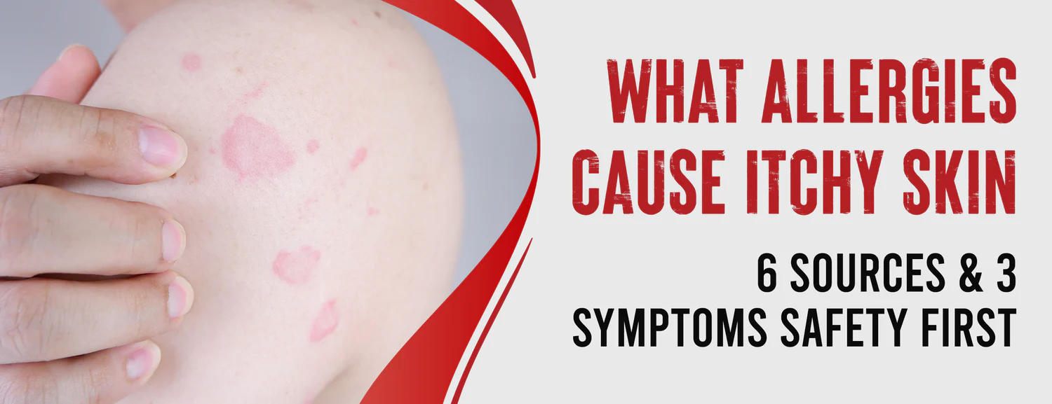 Facts & Tips for Preventing Itchy Skin Caused by Allergies